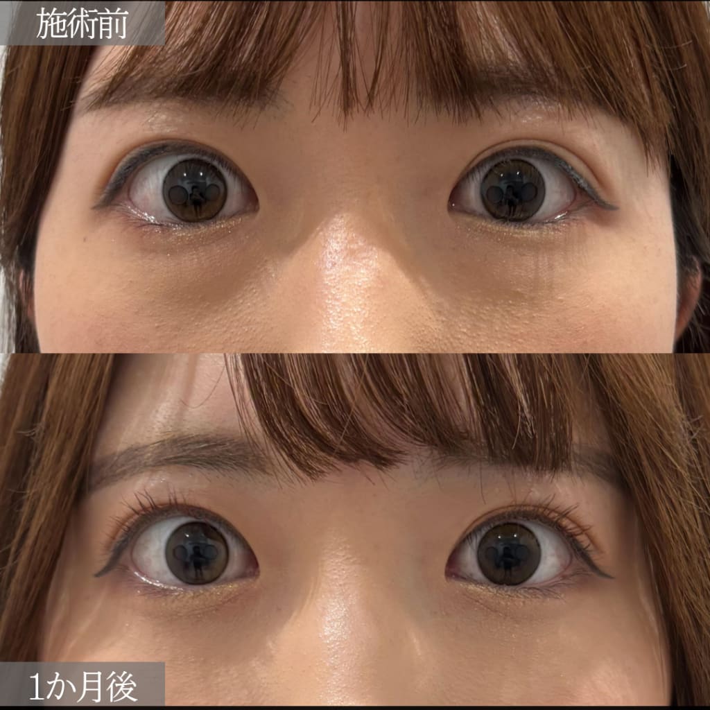 症例のビフォー画像