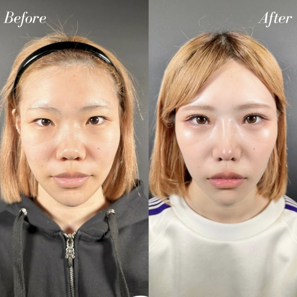 症例のビフォー画像