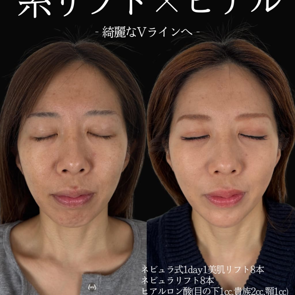 症例のビフォー画像