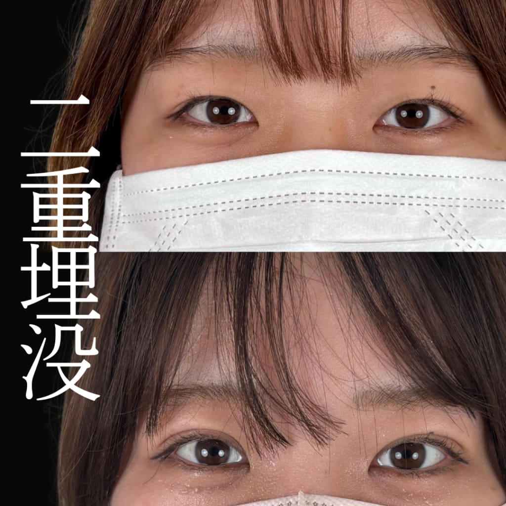 症例のビフォー画像