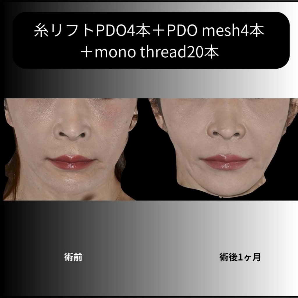 症例のビフォー画像