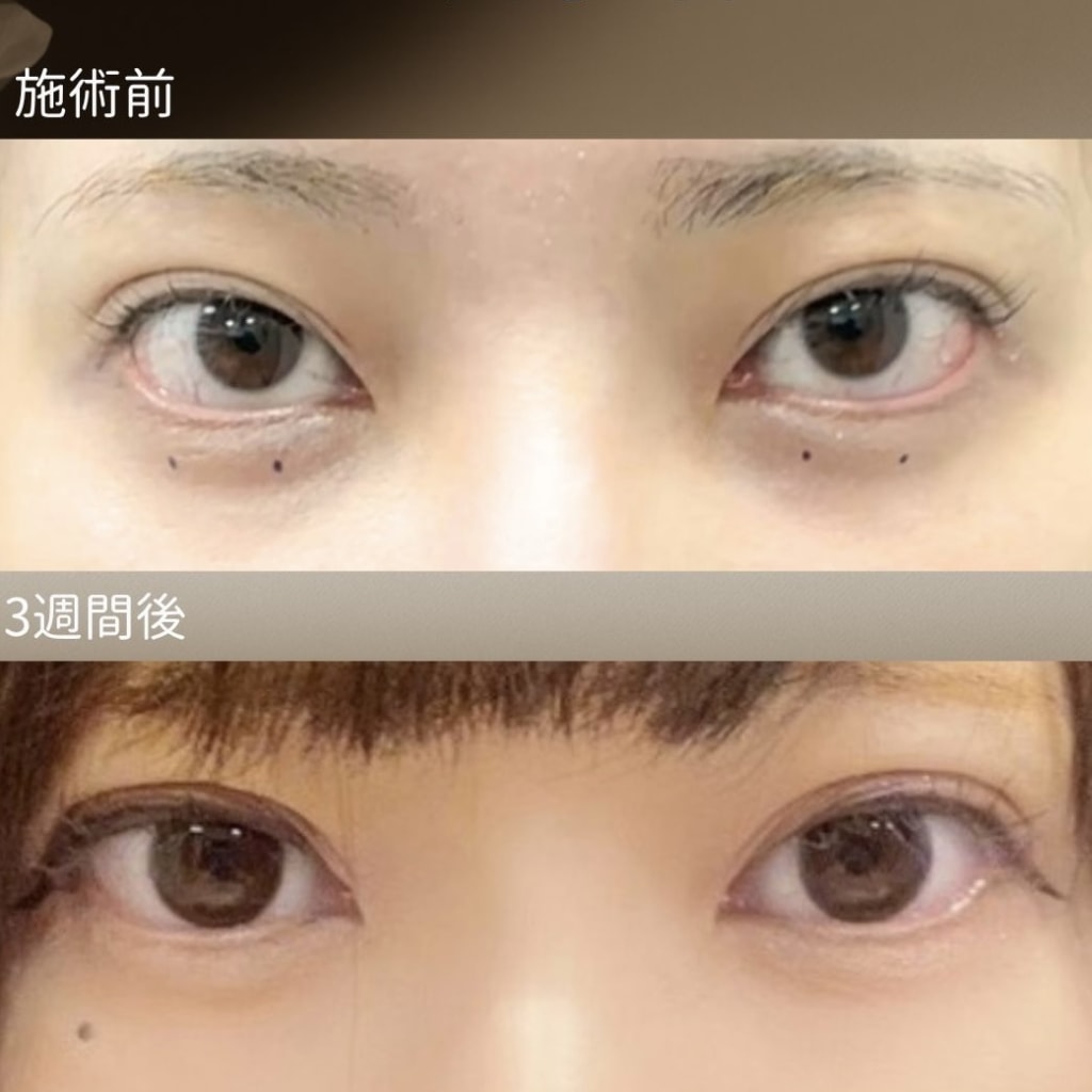 症例のビフォー画像