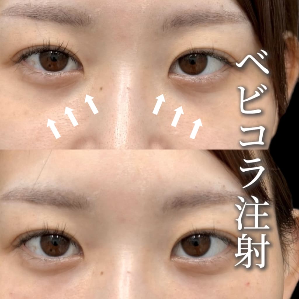 症例のビフォー画像