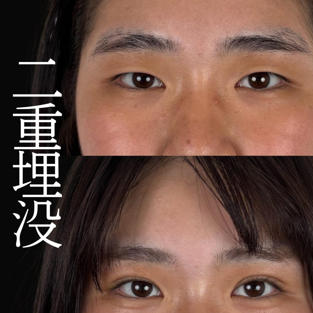 症例のビフォー画像