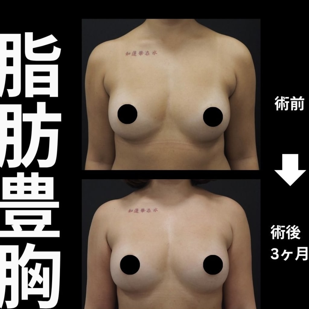 症例のビフォー画像