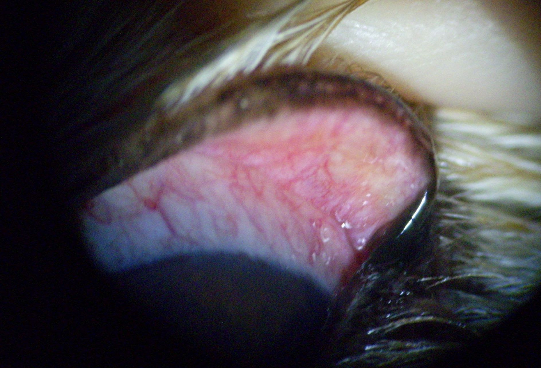 Kötőhártyagyulladás - conjunctivitis