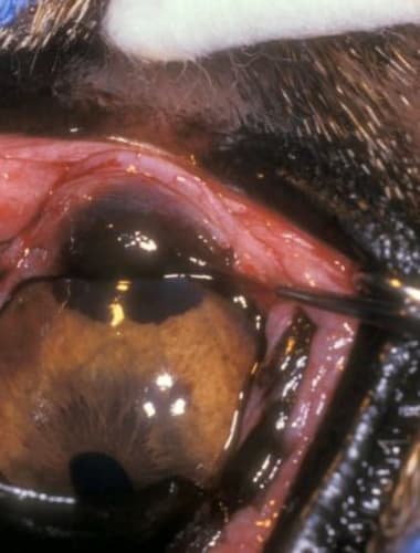 Melanocitóma vs. melanóma malignum