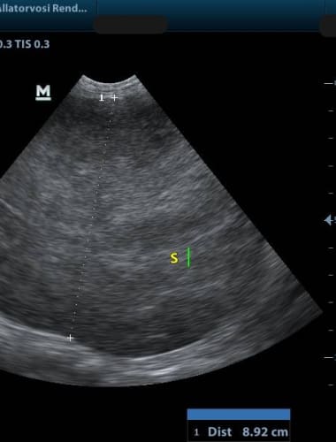 Lépdaganat kutyáknál (hemangiosarcoma)