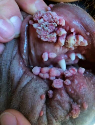 Papilloma és a laphámrák