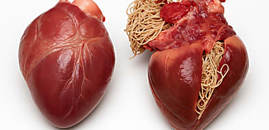 Szívférgesség (d.immitis) - amit tudni kell róla 1. rész