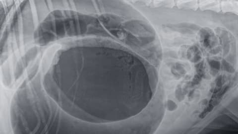 Gyomorcsavar: életveszélyes állapot