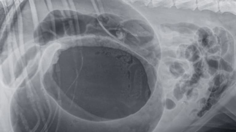 Gyomorcsavar: életveszélyes állapot