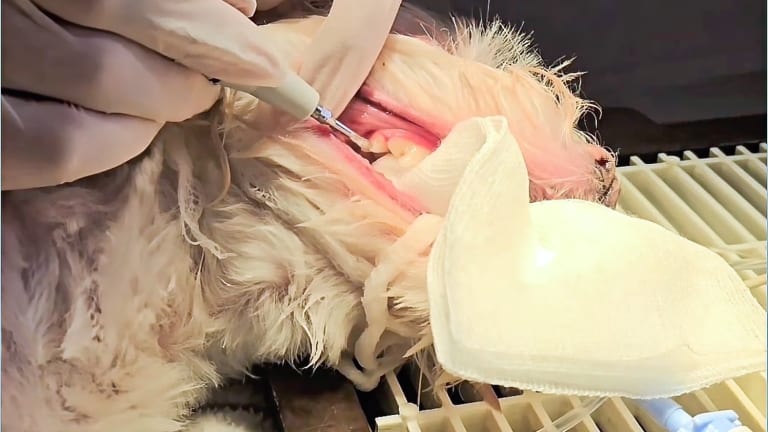 Fogkőeltávolítás altatásban - biztonságos vagy kockázatos?