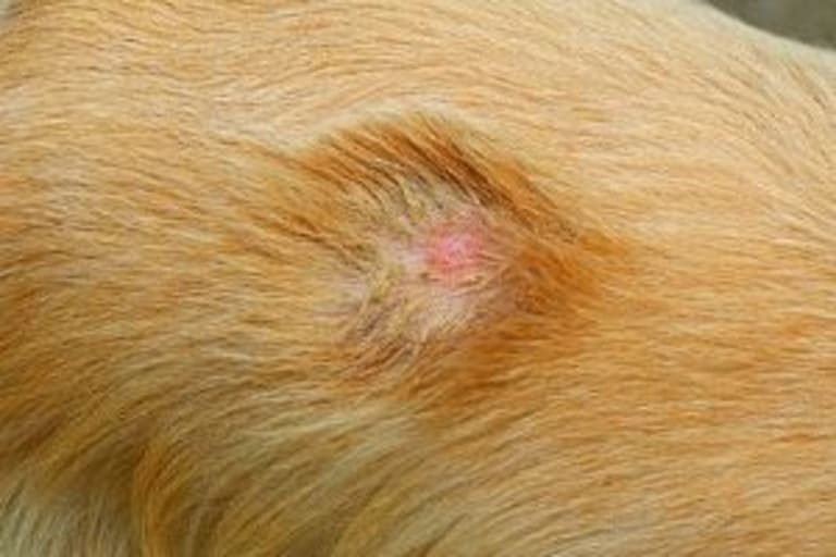 Dermatophytosis