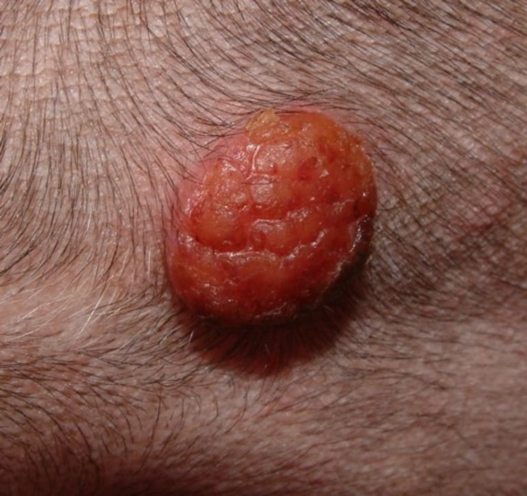 Kutyák és macskák daganatos megbetegedései, és kezelésük