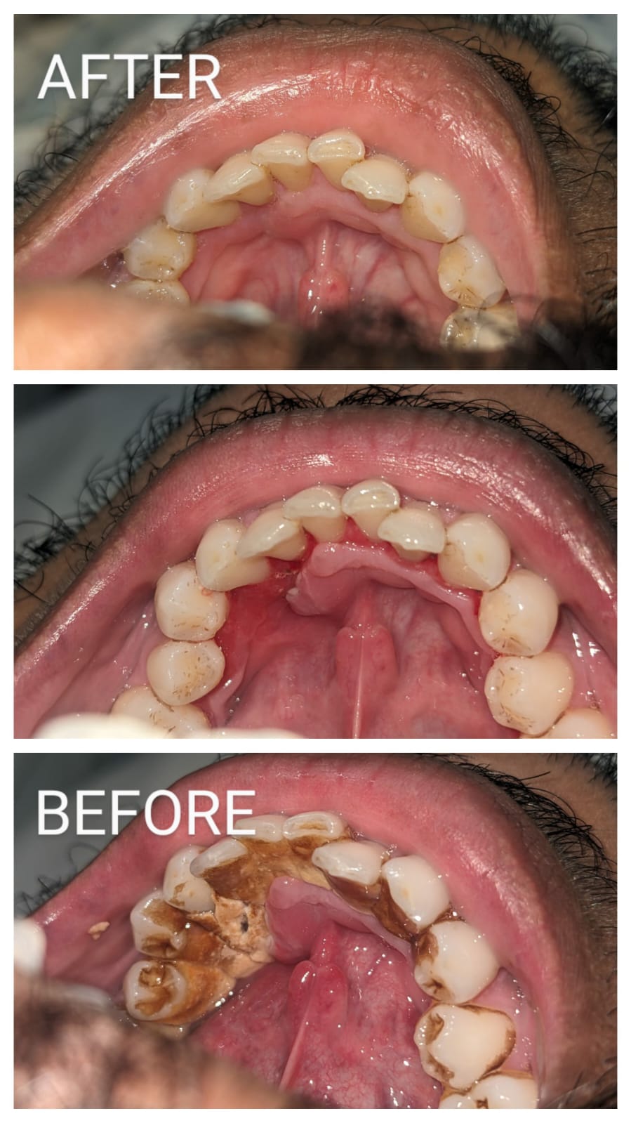 The Best Dental Clinic Kolkata — sterilisation area (photo 29)