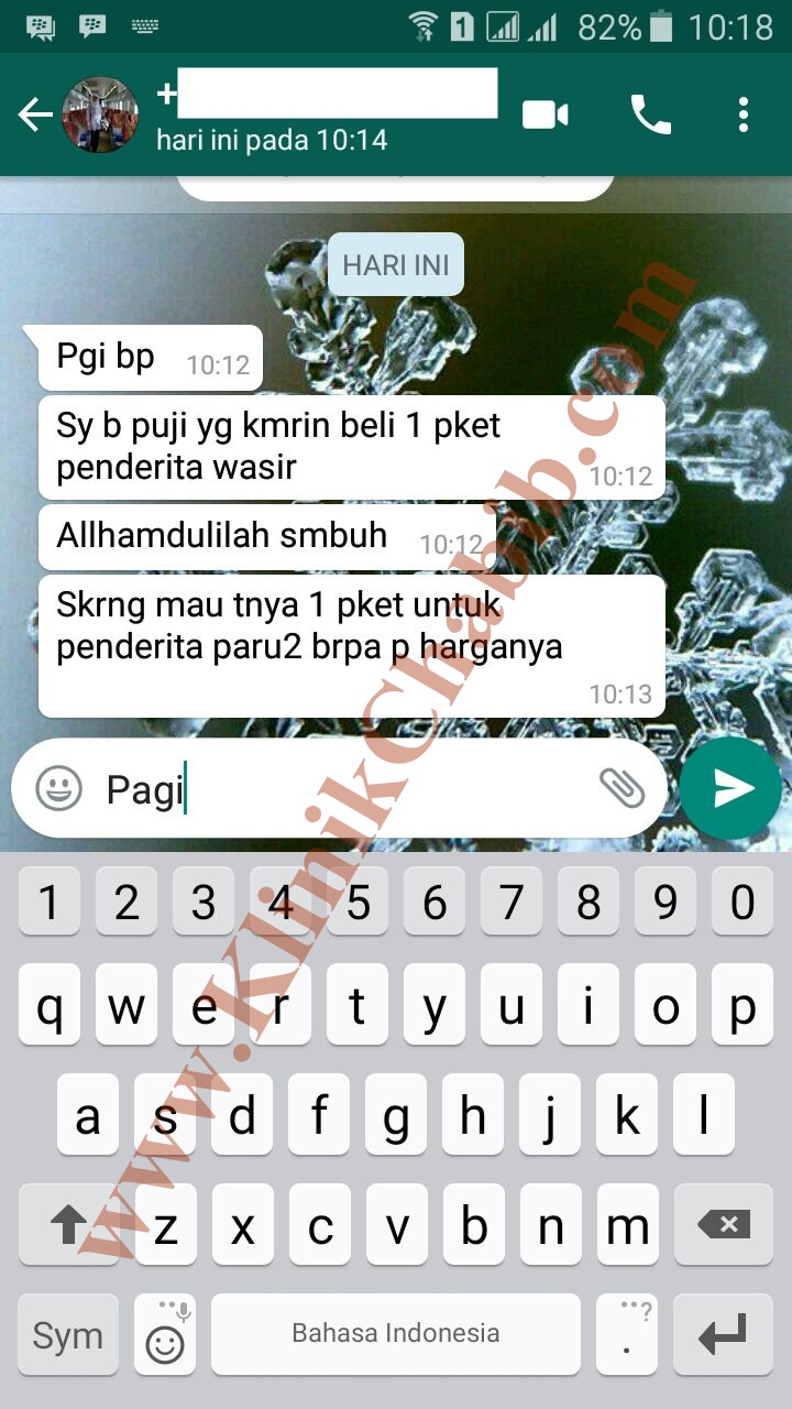 Testimoni mengobati ambeien