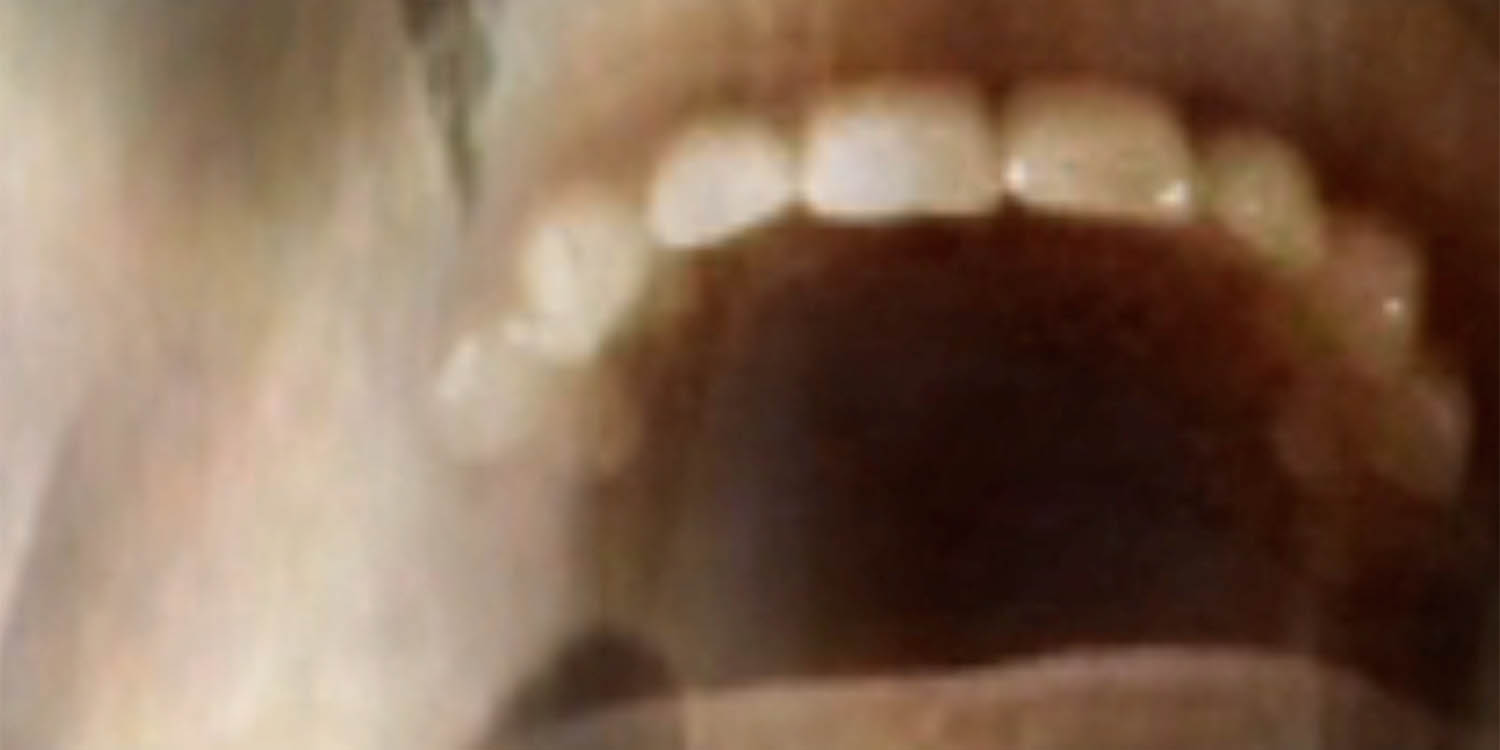 Εικόνα για το πρότζεκτ 'Πονοκέφαλος' του Πολυπράγμων Καλλιτέχνη Κώστα Γκόγκα