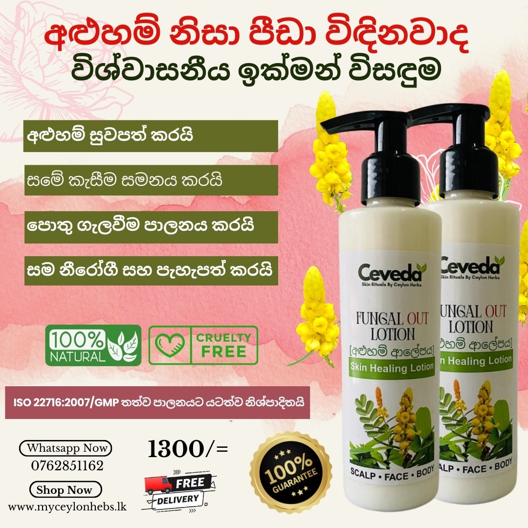 Fungle Out Lotion by Ceveda