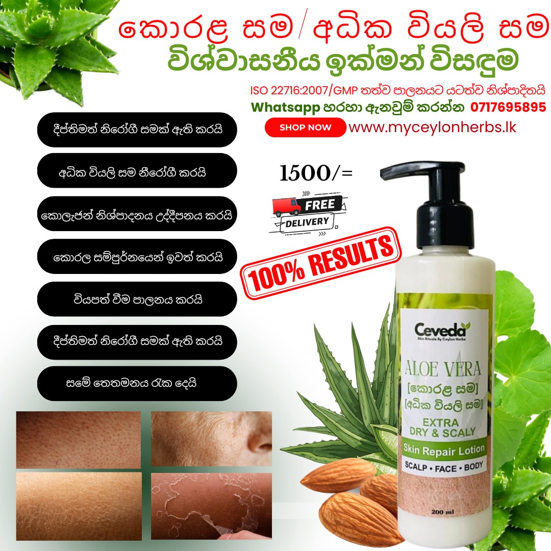 Aloe Vera Scally Skin Lotion by Ceveda