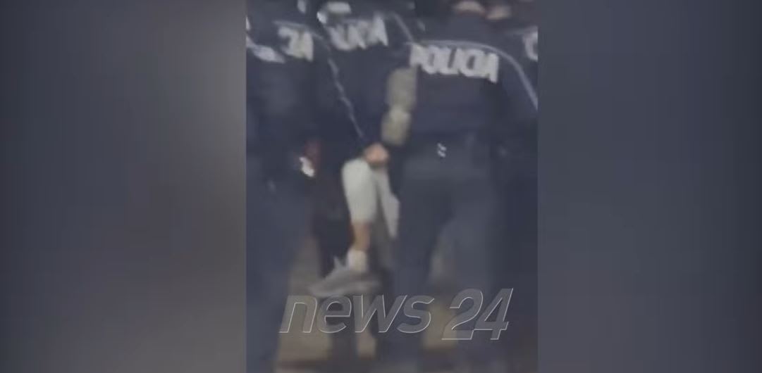 Gjendja shëndetësore e studentit që pësoi thyerje të këmbës nga dhuna e efektivëve të policisë