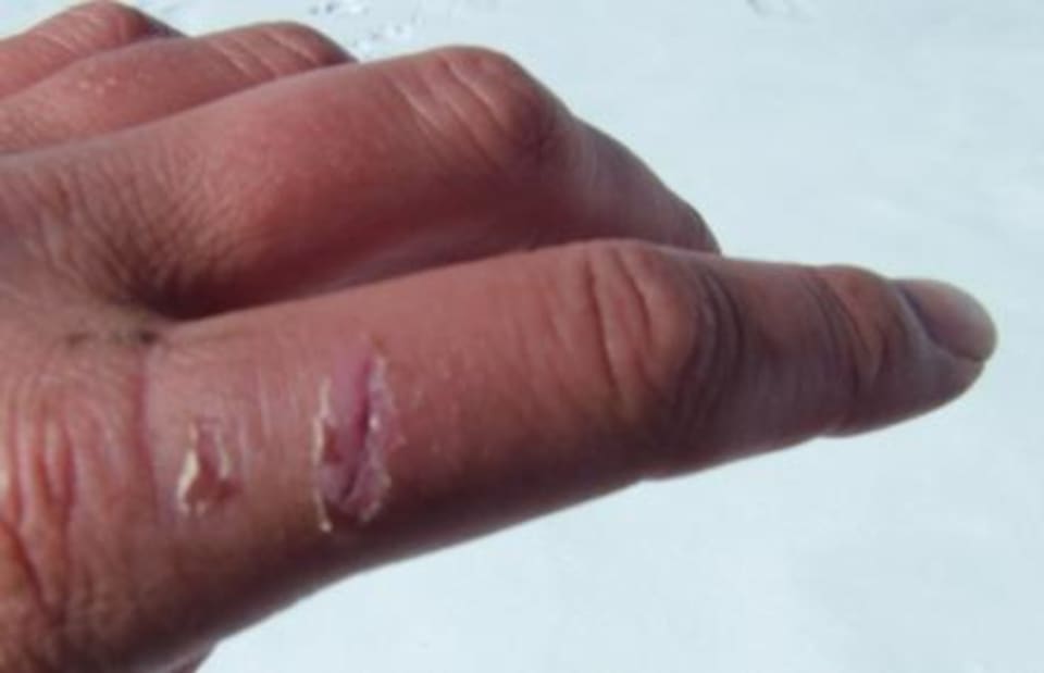 Finger