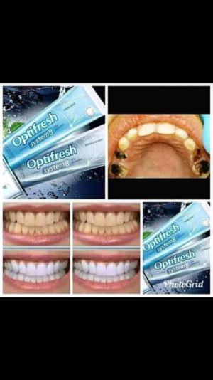 Optifresh a lifetime protection for a tasty and healthy smile