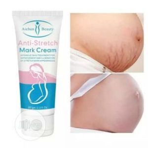 Stretch mark removal