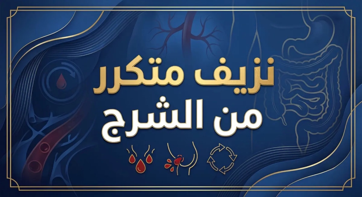 نزيف متكرر من الشرج متى يكون بسبب البواسير ومتى يحتاج إلى تقييم طبي؟
