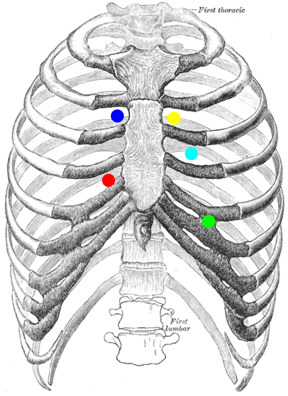 Heart auscultation areas showing aortic, pulmonary, Erb's point, tricuspid and mitral listening areas — public-domain diagram