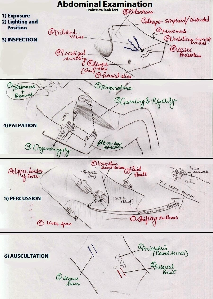 Illustration of abdominal examination techniques — Armanjain011, GFDL