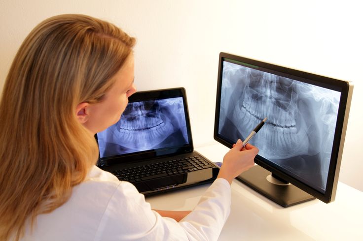 Digital Dental Diagnostics & Bite Analysis