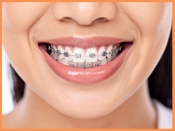 Orthodontic Treatment & Teeth Straightening