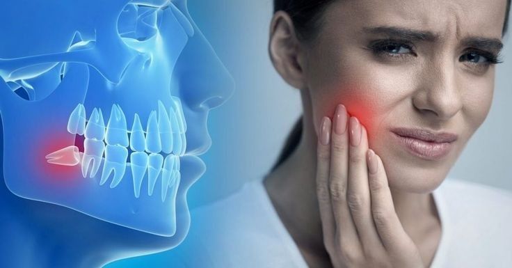 Oral Surgery & Tooth Removal
