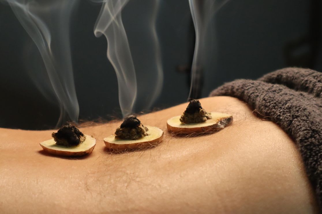 moxibustion-technique-de-la-MTC.jpg