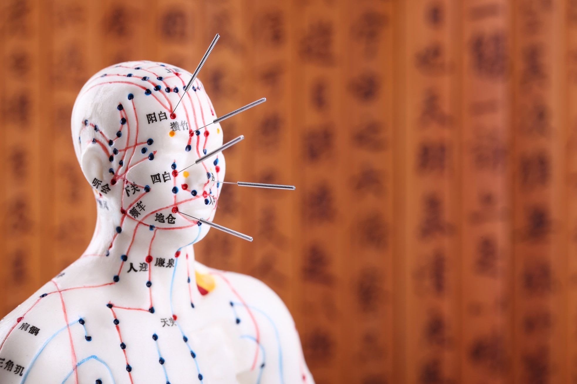 Traitement par-l'acupuncture..jpg