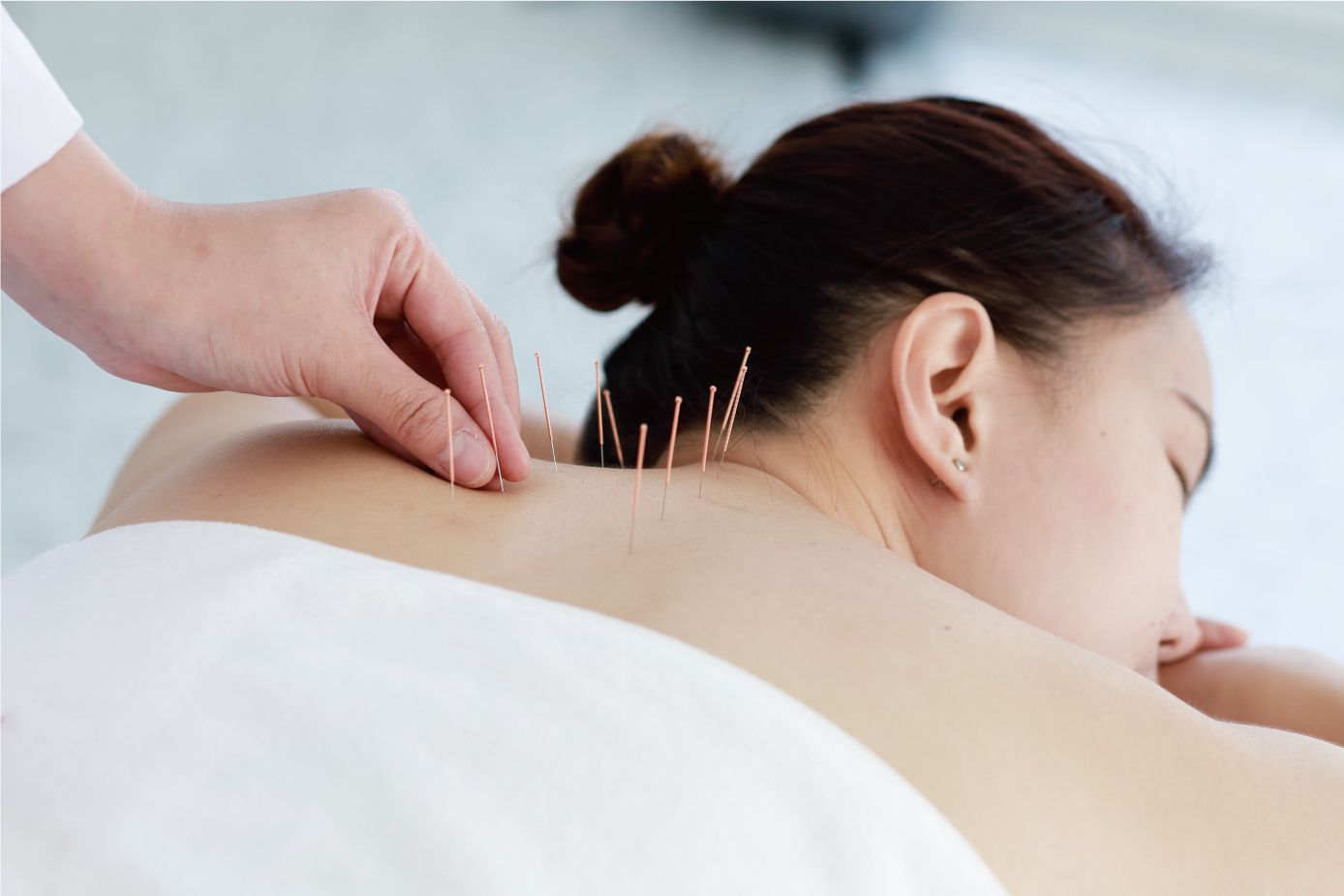 acupuncture_menopause.jpg