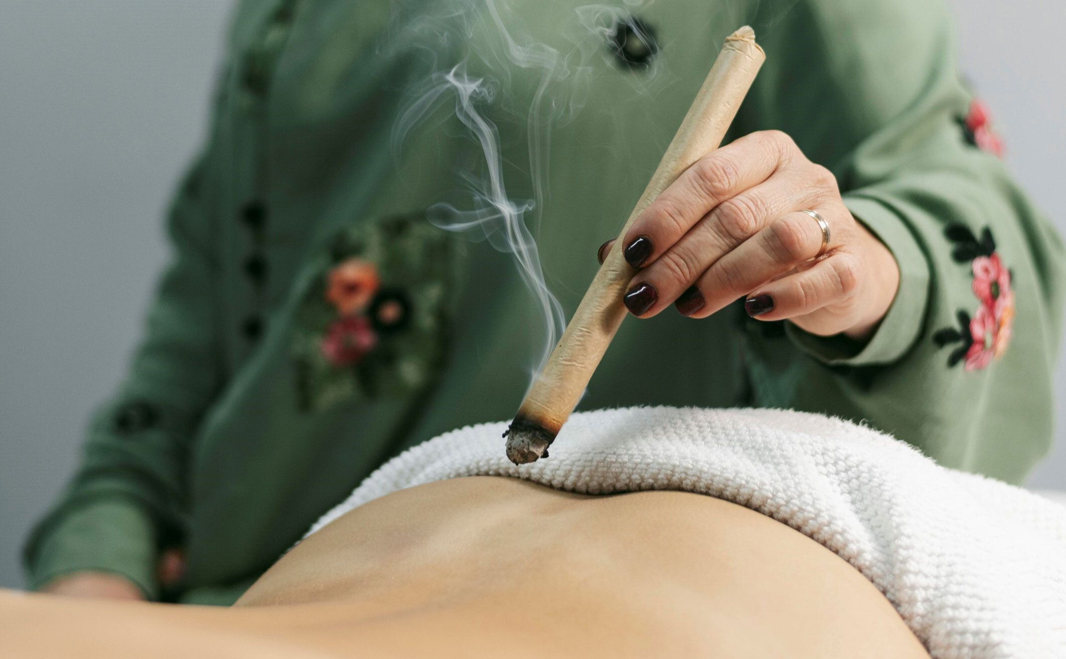 Moxibustion.jpg