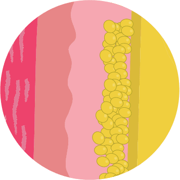 Illustration of stubborn fat