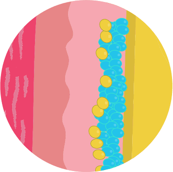Illustration of CoolSculpting killing stubborn fat cells