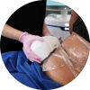 Freeze Stubborn Fat