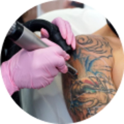 50% Off Your First Laser Tattoo Removal Treatment!