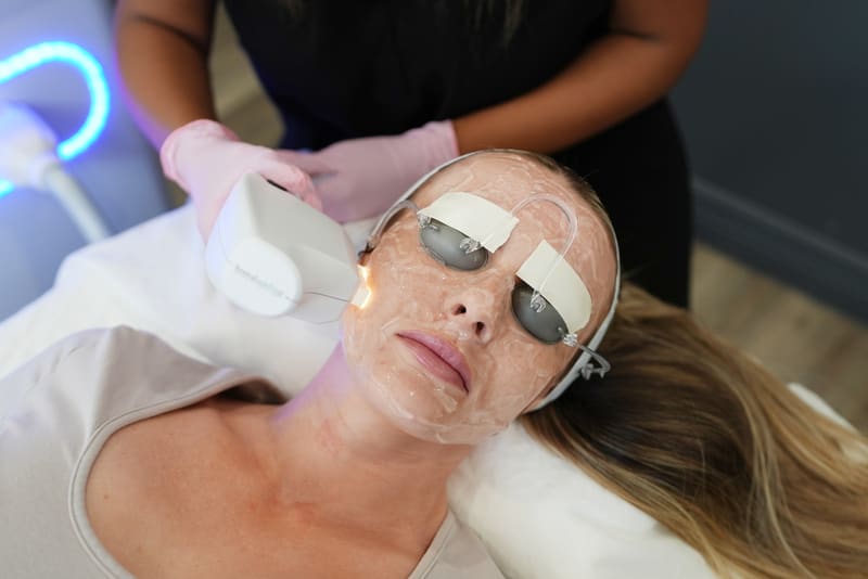 40% Off Your First IPL Photofacial‡