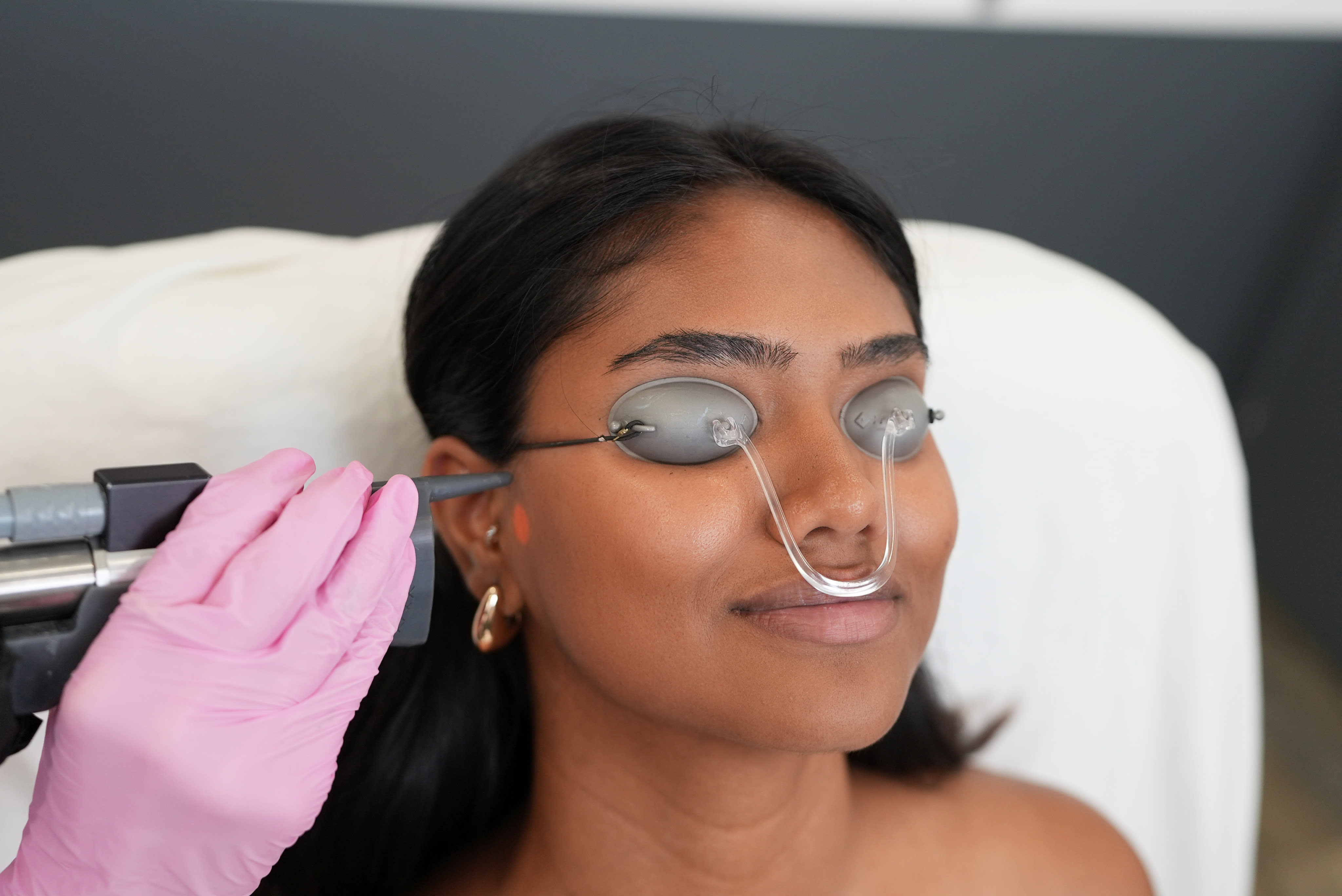 laseraway glutathione Sideburn Laser Hair Removal
