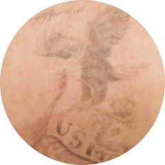 Cover Up treatment area