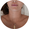 Face + Neck + Chest treatment area