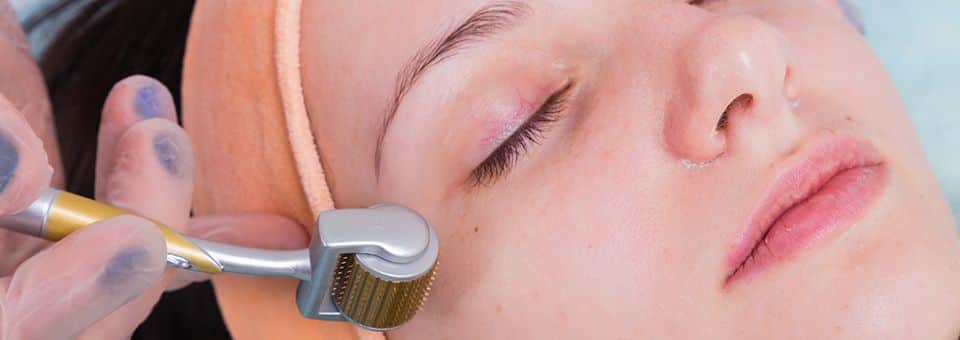 microneedling vs laser facial