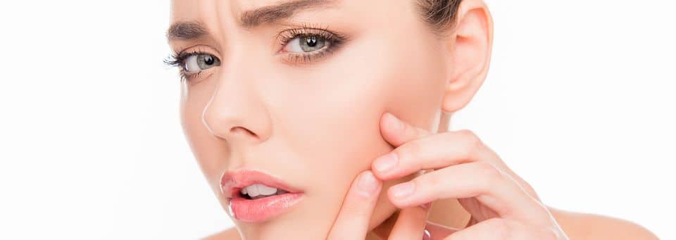 how to get rid of acne