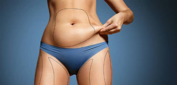 laser body contouring