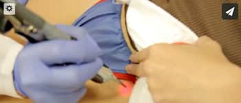 Bikini Line Laser Hair Removal Treatment